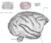 3D brain