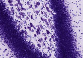nissl hippocampus