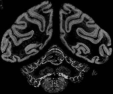brain image analysis
